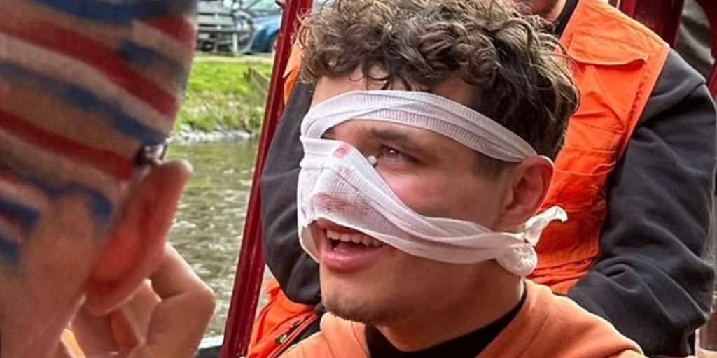 Lando Norris pådrog sig ‘brutal’ ansigtsskade under fest i Amsterdam